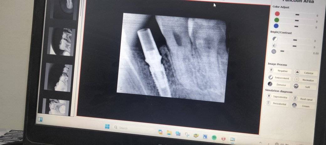 Clinical Case by د/ ابراهيم حسن