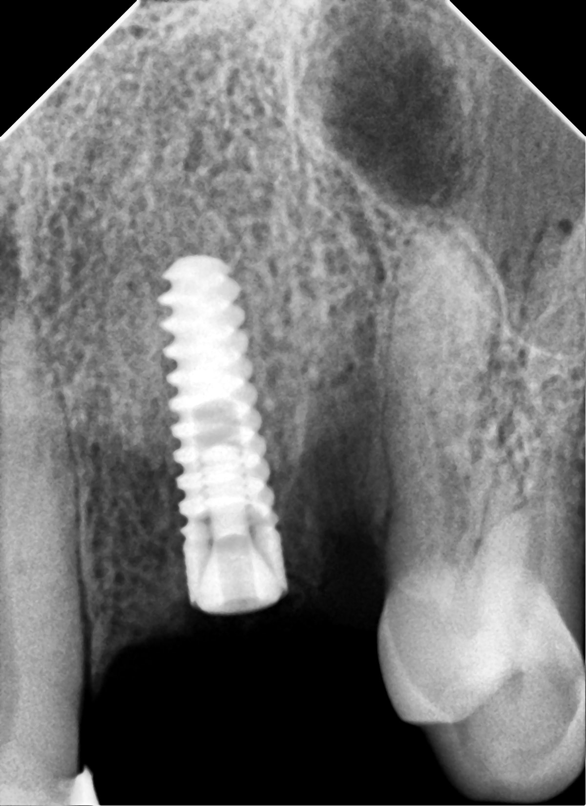 Clinical Case by د/ ادهم عاطف