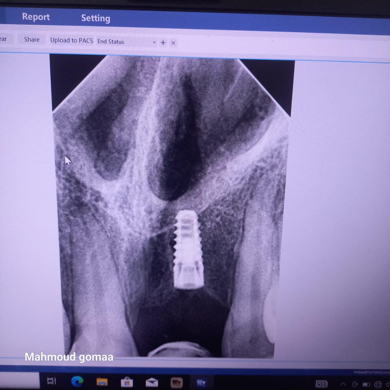 Clinical Case by د/ مالك علي