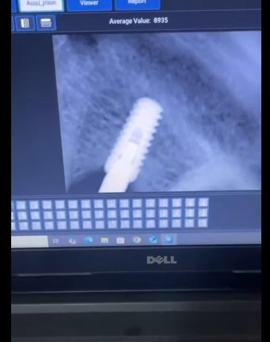 Clinical Case by د/ محمد حماد