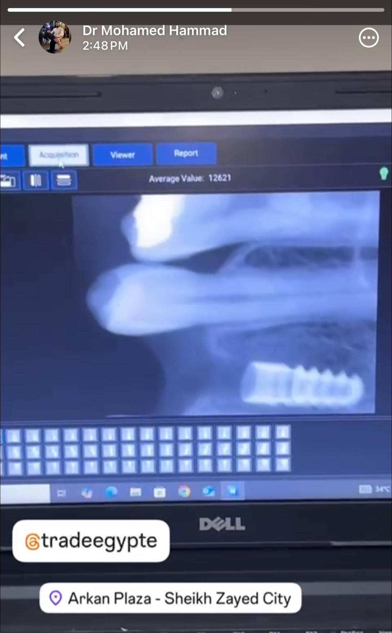 Clinical Case by د/ محمد حماد